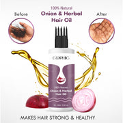 Elephic Onion Hair Oil